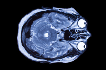 X-ray image of the brain computed tomography