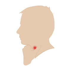 Silhouette of a man's head. throat disease. Hand on the hand. Vector.