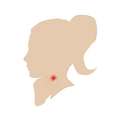 Silhouette of a woman's head. throat disease. Hand on the hand. Vector.