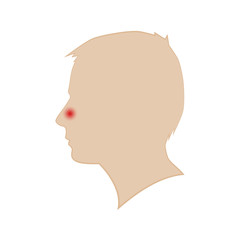 Silhouette of a man's head. Runny nose. Vector.