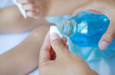 Close up wound on child knee. Mother dressing child's knee.