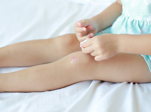 Close Up of child girl dressing wound on knee by self on the bed.
