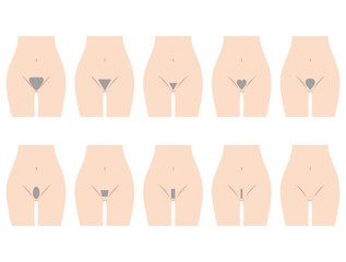 アンダーヘアのデザイン　脱毛