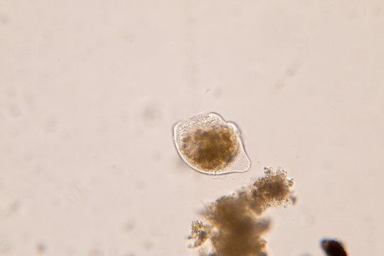 Protozoa in water under microscope view.