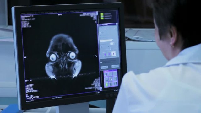 Woman doctor in a hospital explores the tomography brain on the monitor