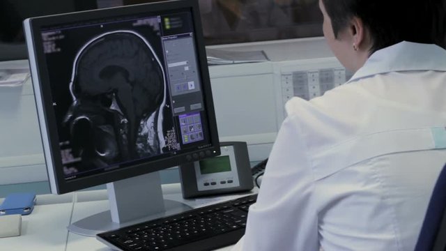 The doctor looks at the image on a computer tomography brain