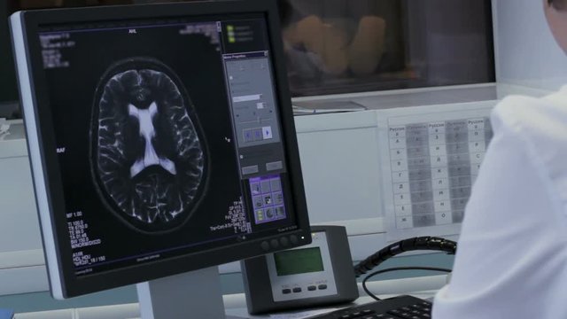 Doctor works at the computer with tomography brain