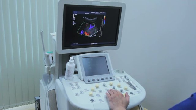 Doctor works at the ultrasound examination unit, colored blood vessels and arteries on monitor