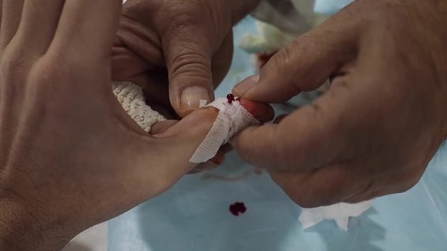 I medicate realizing he recovers from finger in the hand