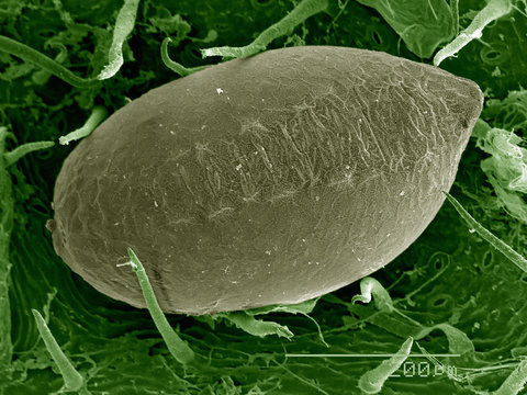 Egg of Psocid (Cerobasis sp.) on leaf surface