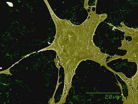 C2C12 mouse cell culture