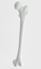 Fracture of the femur - breakpoints - 3D Rendering