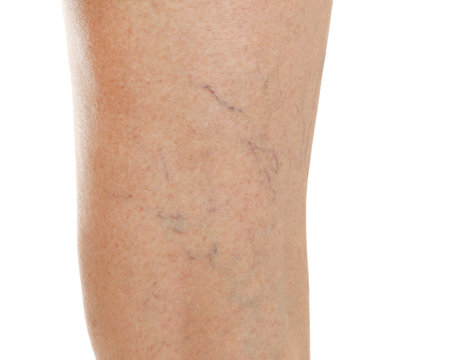 Female leg on white background, closeup