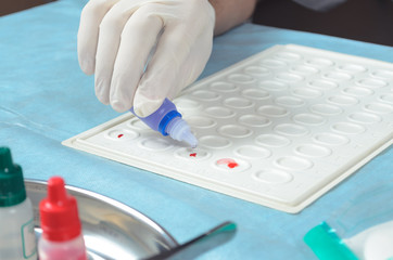 Blood group and rh factor testing