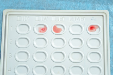 Blood group and rh factor testing