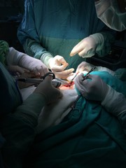 surgery in surgery room