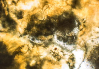 Moldy onion bulb, microscope view