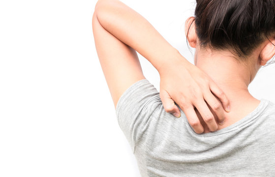 Woman Itching on shoulder with white background for healthy conc