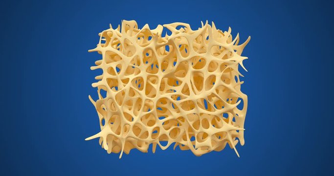 Developing of human bone osteoporosis spongy texture from normal to sick, time lapse 3d animation isolated ob blue background