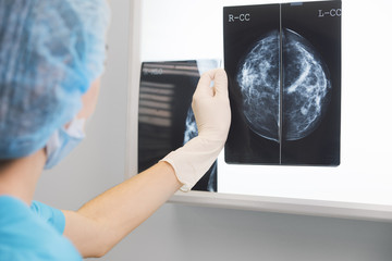 woman doctor or nurse in surgery outfit is holding a mammogram in front of x-ray illuminator - obrazy, fototapety, plakaty