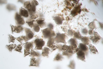 Freshwater Vorticella Campanula by microscope. Benthic water life