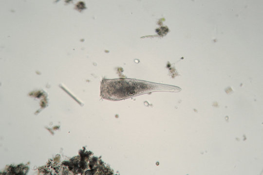 Сiliates infusoria Stentor polymorphic moves by flagella. Protozoa