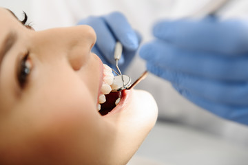 Oral cavity of women taking care by dental instruments