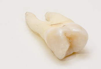 Fototapeta na wymiar human tooth close-up