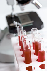 blood in glass tubes on background of microscope