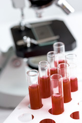 blood in glass tubes on background of microscope
