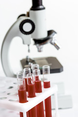 blood in glass tubes on background of microscope