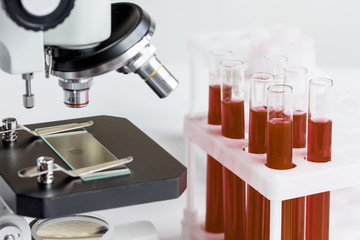 blood in glass tubes on background of microscope