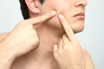 Young man checking his skin, men's skincare concept, acne treatment