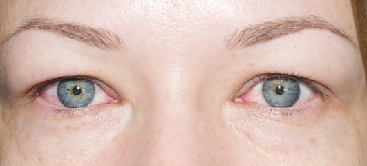 red eyes