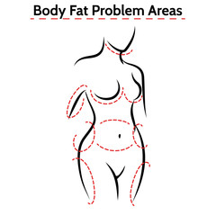 Female body fat problems areas. Vector medical poster with woman silhouette