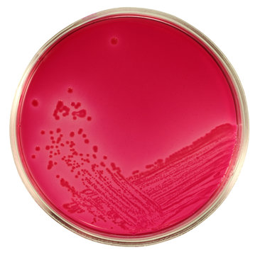 Lactose - negative Escherichia coli bacteria on red agar Endo. Close-up. Isolation by pen. Picture is made on white background.