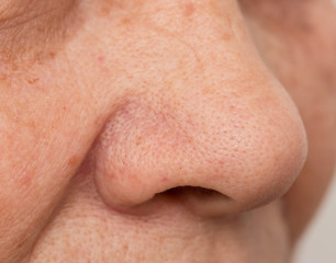 women nose