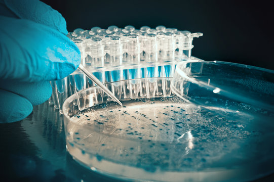 Scientist picks up bacterial colonies