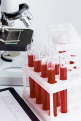 blood in glass tubes on background of microscope