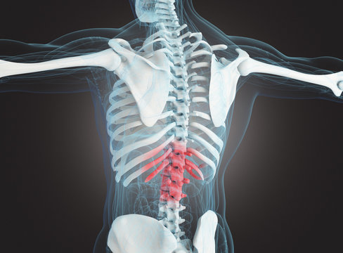 Scheletro osseo con frattura o dolore alla spina dorsale