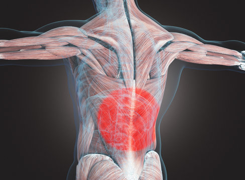 Muscoli lombardi con dolore o rossore