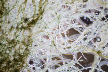 Phytoplankton in waste water under the microscope.