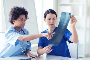 Fototapeta premium female doctors with x-ray image at hospital