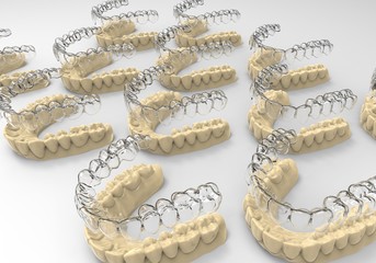3D rendering kappa for teeth