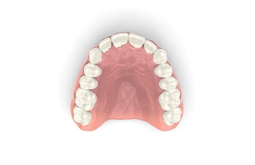 3D rendering dentures
