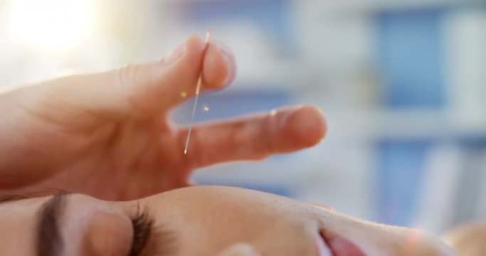 Close-up of woman receiving acupuncture treatment in clinic