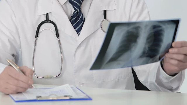 Pulmonology doctor looking at lung scan, making prescription for sick patient