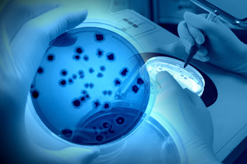 研究イメージ　微生物の計数