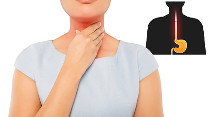 Acid reflux