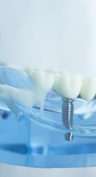 Dental teeth dentistry model